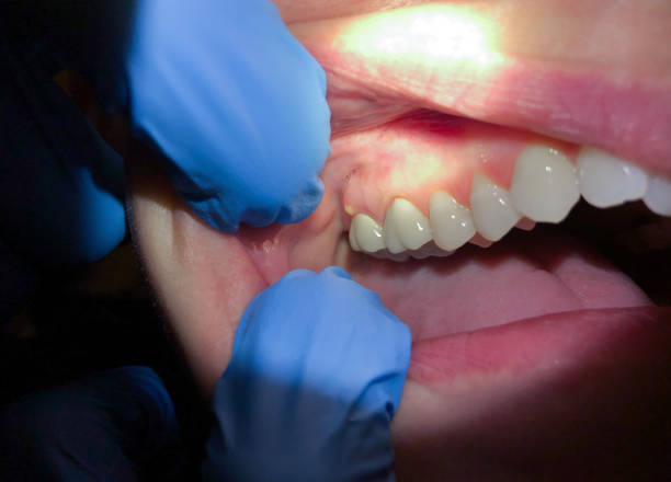  Lakehurst, NJ Emergency Dentist Pros