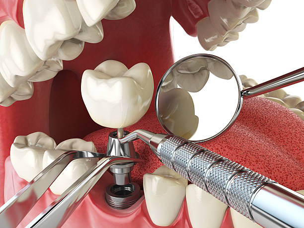 Best Emergency Broken Tooth Repair in Lakehurst, NJ
